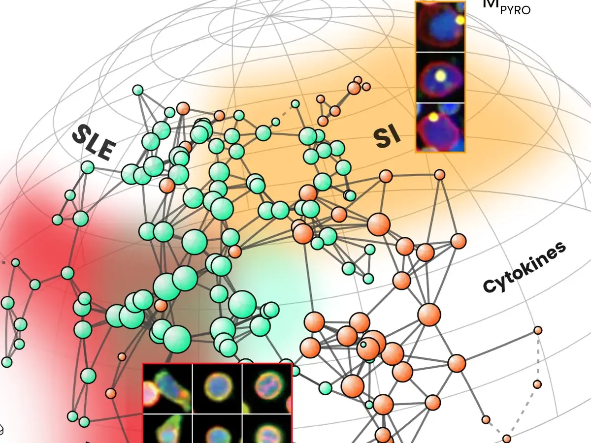 The Functional Immune Manifold, a network of immune responses across SLE, RA and systemic inflammation